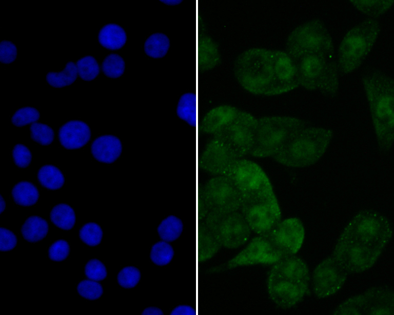 ICC staining eIF4A3 in LOVO cells (green). The nuclear counter stain is DAPI (blue). Cells were fixed in paraformaldehyde, permeabilised with 0.25% Triton X100/PBS.