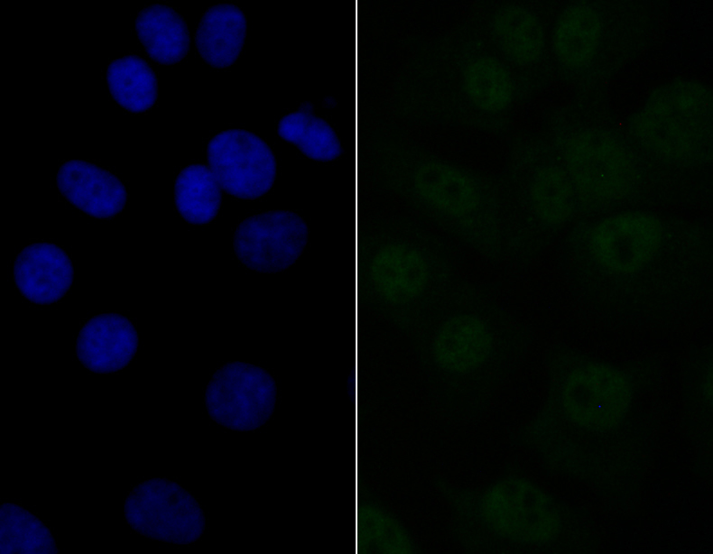 ICC staining eIF4A3 in MCF-7 cells (green). The nuclear counter stain is DAPI (blue). Cells were fixed in paraformaldehyde, permeabilised with 0.25% Triton X100/PBS.