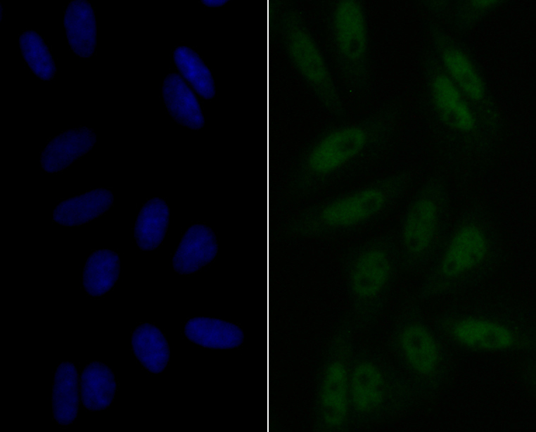 ICC staining eIF4A3 in SiHa cells (green). The nuclear counter stain is DAPI (blue). Cells were fixed in paraformaldehyde, permeabilised with 0.25% Triton X100/PBS.