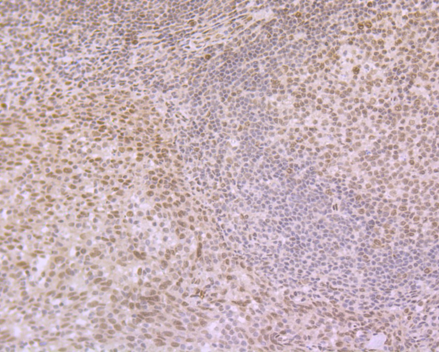 Immunohistochemical analysis of paraffin-embedded human tonsil tissue using anti-eIF4A3 antibody. Counter stained with hematoxylin.