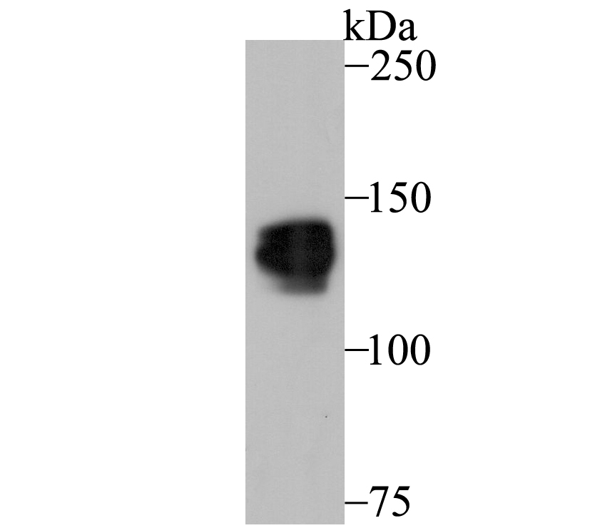 Western blot analysis of Pumilio 1 on SiHa cell lysate using anti-Pumilio 1 antibody at 1/1,000 dilution.