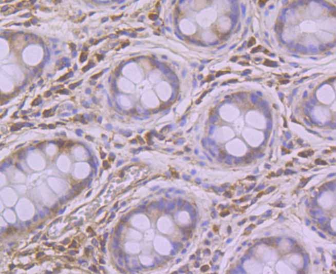 Immunohistochemical analysis of paraffin-embedded human colon tissue using anti-Pumilio 1 antibody. Counter stained with hematoxylin.