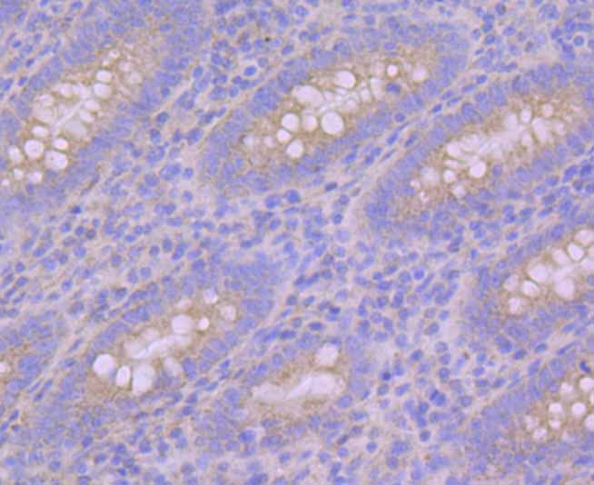 Immunohistochemical analysis of paraffin-embedded human appendix tissue using anti-Pumilio 1 antibody. Counter stained with hematoxylin.