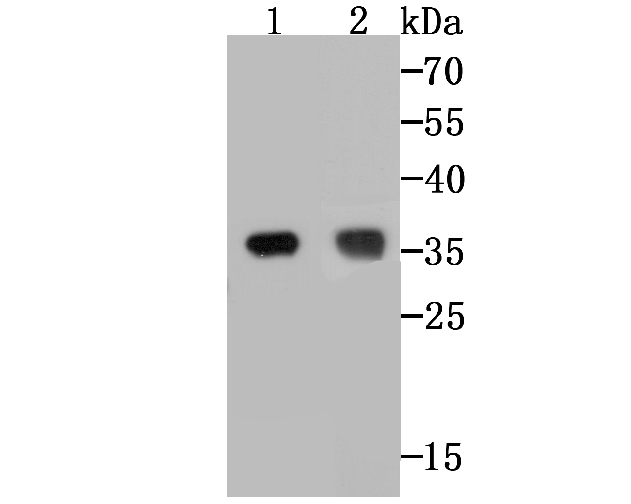 Western blot analysis of TREX1 on different lysates. Proteins were transferred to a PVDF membrane and blocked with 5% BSA in PBS for 1 hour at room temperature. The primary antibody (ET7108-16, 1/500) was used in 5% BSA at room temperature for 2 hours. Goat Anti-Rabbit IgG - HRP Secondary Antibody (HA1001) at 1:40,000 dilution was used for 1 hour at room temperature.<br />
Positive control: <br />
Lane 1: A431 cell lysate<br />
Lane 2: SK-Br-3 cell lysate