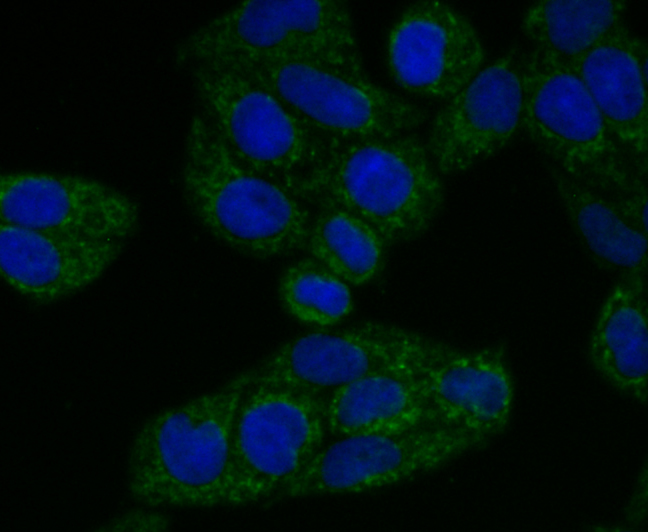 ICC staining of TREX1 in Hela cells (green). Formalin fixed cells were permeabilized with 0.1% Triton X-100 in TBS for 10 minutes at room temperature and blocked with 1% Blocker BSA for 15 minutes at room temperature. Cells were probed with the primary antibody (ET7108-16, 1/50) for 1 hour at room temperature, washed with PBS. Alexa Fluor®488 Goat anti-Rabbit IgG was used as the secondary antibody at 1/1,000 dilution. The nuclear counter stain is DAPI (blue).