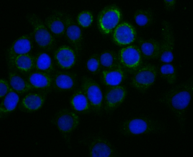 ICC staining of TREX1 in LOVO cells (green). Formalin fixed cells were permeabilized with 0.1% Triton X-100 in TBS for 10 minutes at room temperature and blocked with 1% Blocker BSA for 15 minutes at room temperature. Cells were probed with the primary antibody (ET7108-16, 1/50) for 1 hour at room temperature, washed with PBS. Alexa Fluor®488 Goat anti-Rabbit IgG was used as the secondary antibody at 1/1,000 dilution. The nuclear counter stain is DAPI (blue).