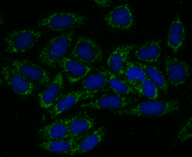 ICC staining of TREX1 in SiHa cells (green). Formalin fixed cells were permeabilized with 0.1% Triton X-100 in TBS for 10 minutes at room temperature and blocked with 1% Blocker BSA for 15 minutes at room temperature. Cells were probed with the primary antibody (ET7108-16, 1/50) for 1 hour at room temperature, washed with PBS. Alexa Fluor®488 Goat anti-Rabbit IgG was used as the secondary antibody at 1/1,000 dilution. The nuclear counter stain is DAPI (blue).