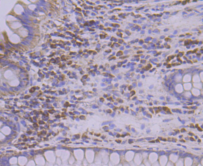 Immunohistochemical analysis of paraffin-embedded human colon tissue using anti-TREX1 antibody. The section was pre-treated using heat mediated antigen retrieval with Tris-EDTA buffer (pH 8.0-8.4) for 20 minutes.The tissues were blocked in 5% BSA for 30 minutes at room temperature, washed with ddH2O and PBS, and then probed with the primary antibody (ET7108-16, 1/50) for 30 minutes at room temperature. The detection was performed using an HRP conjugated compact polymer system. DAB was used as the chromogen. Tissues were counterstained with hematoxylin and mounted with DPX.