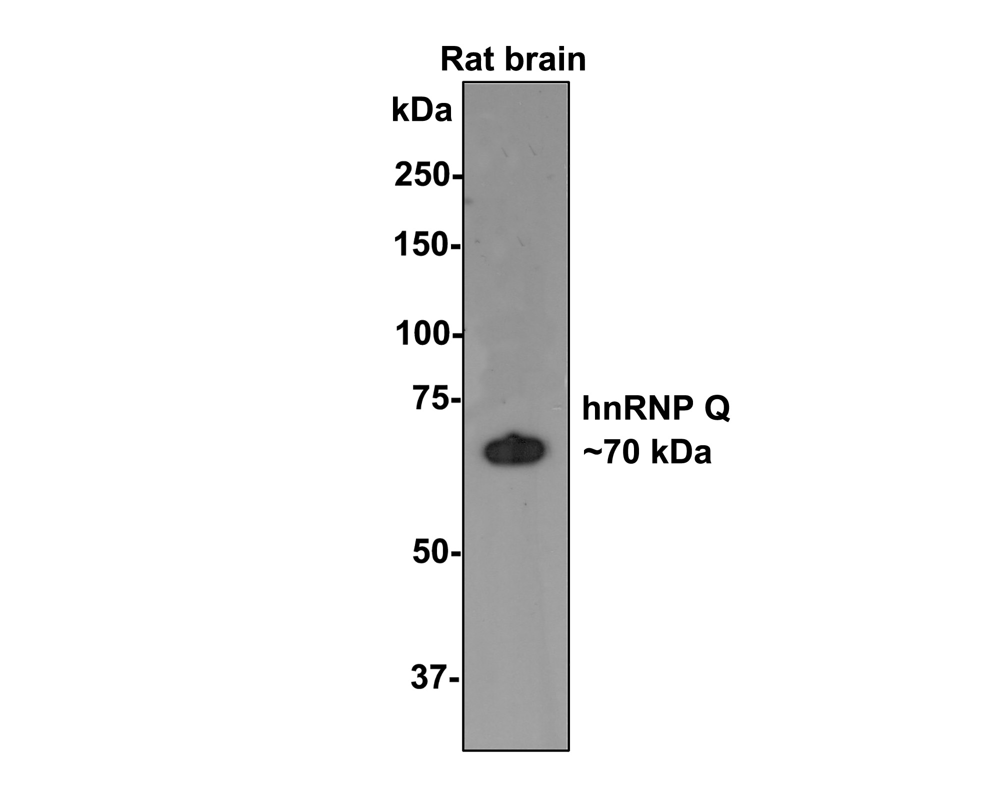 Western blot analysis of hnRNP Q on rat brain tissue lysates with Rabbit anti-hnRNP Q antibody (ET7108-17) at 1/500 dilution.<br />
<br />
Lysates/proteins at 20 µg/Lane.<br />
<br />
Predicted band size: 70 kDa<br />
Observed band size: 70 kDa<br />
<br />
Exposure time: 2 minutes;<br />
<br />
8% SDS-PAGE gel.<br />
<br />
Proteins were transferred to a PVDF membrane and blocked with 5% NFDM/TBST for 1 hour at room temperature. The primary antibody (ET7108-17) at 1/500 dilution was used in 5% NFDM/TBST at room temperature for 2 hours. Goat Anti-Rabbit IgG - HRP Secondary Antibody (HA1001) at 1:200,000 dilution was used for 1 hour at room temperature.