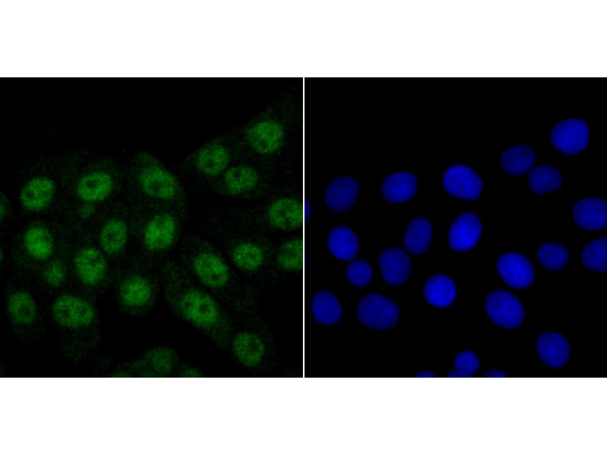 ICC staining of hnRNP Q in LOVO cells (green). Formalin fixed cells were permeabilized with 0.1% Triton X-100 in TBS for 10 minutes at room temperature and blocked with 10% negative goat serum for 15 minutes at room temperature. Cells were probed with the primary antibody (ET7108-17, 1/50) for 1 hour at room temperature, washed with PBS. Alexa Fluor®488 conjugate-Goat anti-Rabbit IgG was used as the secondary antibody at 1/1,000 dilution. The nuclear counter stain is DAPI (blue).