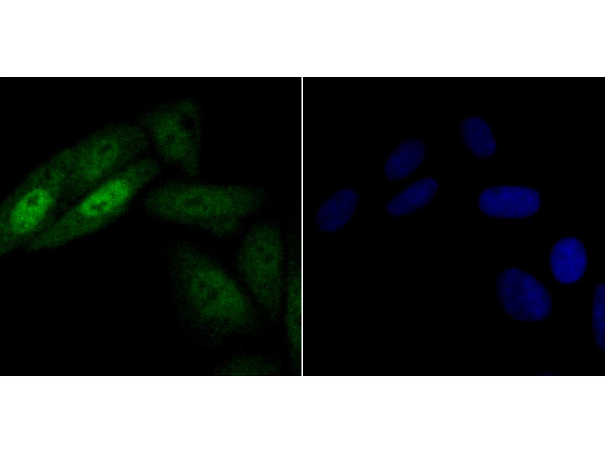 ICC staining of hnRNP Q in SiHa cells (green). Formalin fixed cells were permeabilized with 0.1% Triton X-100 in TBS for 10 minutes at room temperature and blocked with 10% negative goat serum for 15 minutes at room temperature. Cells were probed with the primary antibody (ET7108-17, 1/50) for 1 hour at room temperature, washed with PBS. Alexa Fluor®488 conjugate-Goat anti-Rabbit IgG was used as the secondary antibody at 1/1,000 dilution. The nuclear counter stain is DAPI (blue).