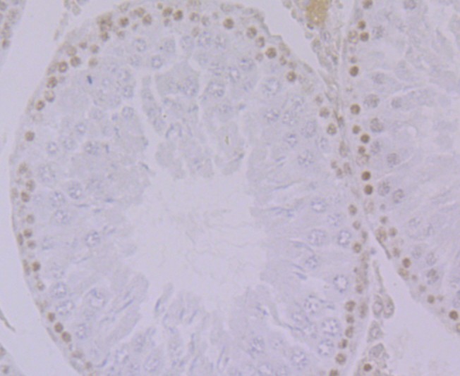 Immunohistochemical analysis of paraffin-embedded rat testis tissue using anti-hnRNP Q antibody. The section was pre-treated using heat mediated antigen retrieval with Tris-EDTA buffer (pH 9.0) for 20 minutes.The tissues were blocked in 1% BSA for 30 minutes at room temperature, washed with ddH2O and PBS, and then probed with the primary antibody (ET7108-17, 1/50) for 30 minutes at room temperature. The detection was performed using an HRP conjugated compact polymer system. DAB was used as the chromogen. Tissues were counterstained with hematoxylin and mounted with DPX.