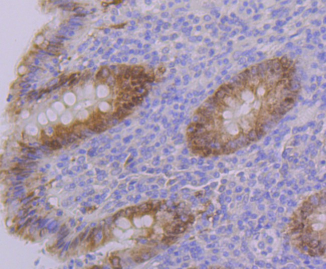 Immunohistochemical analysis of paraffin-embedded human appendix tissue using anti-PON2 antibody. The section was pre-treated using heat mediated antigen retrieval with Tris-EDTA buffer (pH 8.0-8.4) for 20 minutes.The tissues were blocked in 5% BSA for 30 minutes at room temperature, washed with ddH2O and PBS, and then probed with the primary antibody (ET7108-19, 1/50) for 30 minutes at room temperature. The detection was performed using an HRP conjugated compact polymer system. DAB was used as the chromogen. Tissues were counterstained with hematoxylin and mounted with DPX.