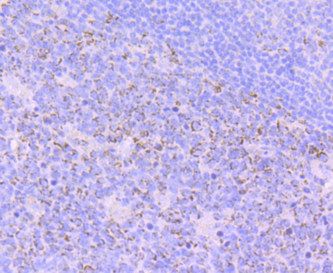 Immunohistochemical analysis of paraffin-embedded human tonsil tissue with Rabbit anti-Emi1 antibody (ET7108-20) at 1/50 dilution.<br />
<br />
The section was pre-treated using heat mediated antigen retrieval with Tris-EDTA buffer (pH 8.0-8.4)) for 20 minutes. The tissues were blocked in 1% BSA for 20 minutes at room temperature, washed with ddH2O and PBS, and then probed with the primary antibody (ET7108-20) at 1/50 dilution for 0.5 hour at room temperature. The detection was performed using an HRP conjugated compact polymer system. DAB was used as the chromogen. Tissues were counterstained with hematoxylin and mounted with DPX.