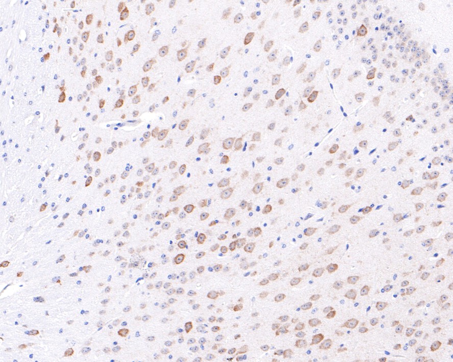 Immunohistochemical analysis of paraffin-embedded mouse brain <br />
 tissue with Rabbit anti-Emi1 antibody (ET7108-20) at 1/400 dilution.<br />
<br />
The section was pre-treated using heat mediated antigen retrieval with Tris-EDTA buffer (pH 9.0) for 20 minutes. The tissues were blocked in 1% BSA for 20 minutes at room temperature, washed with ddH2O and PBS, and then probed with the primary antibody (ET7108-20) at 1/400 dilution for 1 hour at room temperature. The detection was performed using an HRP conjugated compact polymer system. DAB was used as the chromogen. Tissues were counterstained with hematoxylin and mounted with DPX.