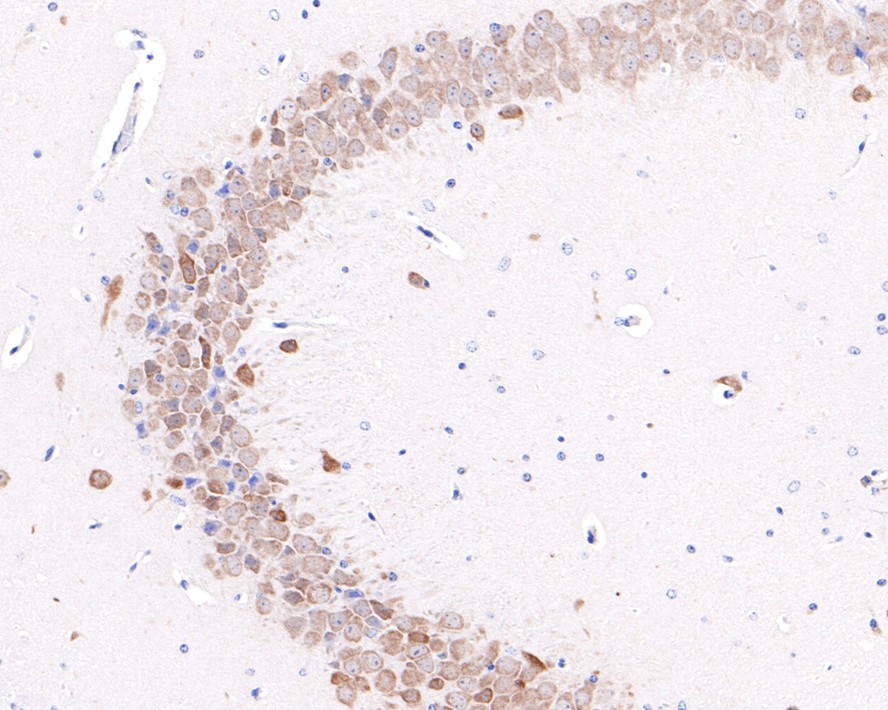 Immunohistochemical analysis of paraffin-embedded mouse hippocampus tissue with Rabbit anti-Emi1 antibody (ET7108-20) at 1/400 dilution.<br />
<br />
The section was pre-treated using heat mediated antigen retrieval with Tris-EDTA buffer (pH 9.0) for 20 minutes. The tissues were blocked in 1% BSA for 20 minutes at room temperature, washed with ddH2O and PBS, and then probed with the primary antibody (ET7108-20) at 1/400 dilution for 1 hour at room temperature. The detection was performed using an HRP conjugated compact polymer system. DAB was used as the chromogen. Tissues were counterstained with hematoxylin and mounted with DPX.