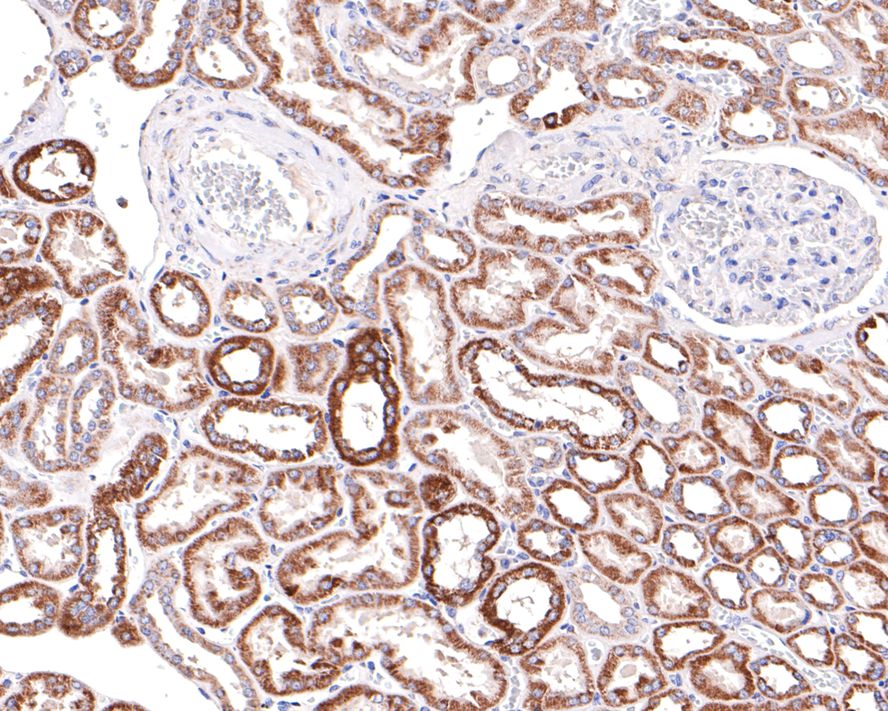 Immunohistochemical analysis of paraffin-embedded Human kidney with Rabbit anti-Emi1 antibody (ET7108-20) at 1/400 dilution.<br />
<br />
The section was pre-treated using heat mediated antigen retrieval with Tris-EDTA buffer (pH 9.0) for 20 minutes. The tissues were blocked in 1% BSA for 20 minutes at room temperature, washed with ddH2O and PBS, and then probed with the primary antibody (ET7108-20) at 1/400 dilution for 1 hour at room temperature. The detection was performed using an HRP conjugated compact polymer system. DAB was used as the chromogen. Tissues were counterstained with hematoxylin and mounted with DPX.