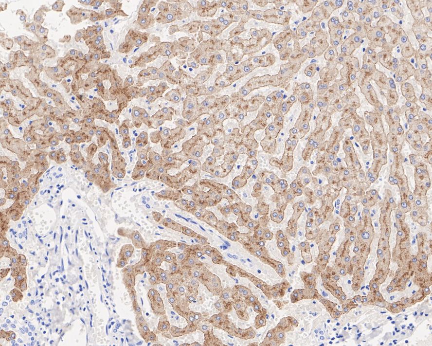 Immunohistochemical analysis of paraffin-embedded human liver tissue with Rabbit anti-Transferrin Receptor 2 antibody (ET7108-21) at 1/1,000 dilution.<br />
<br />
The section was pre-treated using heat mediated antigen retrieval with Tris-EDTA buffer (pH 9.0) for 20 minutes. The tissues were blocked in 1% BSA for 20 minutes at room temperature, washed with ddH2O and PBS, and then probed with the primary antibody (ET7108-21) at 1/1,000 dilution for 1 hour at room temperature. The detection was performed using an HRP conjugated compact polymer system. DAB was used as the chromogen. Tissues were counterstained with hematoxylin and mounted with DPX.