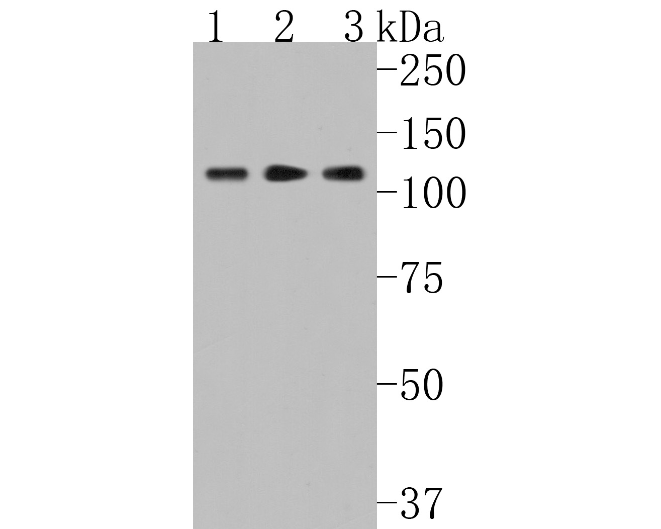 Western blot analysis of CENPC on different lysates with Rabbit anti-CENPC antibody (ET7108-24) at 1/500 dilution.<br />
<br />
Lane 1: HL-60 cell lysate<br />
Lane 2: Daudi cell lysate<br />
Lane 3: K562 cell lysate<br />
<br />
Lysates/proteins at 10 µg/Lane.<br />
<br />
Predicted band size: 107 kDa<br />
Observed band size: 107 kDa<br />
<br />
Exposure time: 2 minutes;<br />
<br />
10% SDS-PAGE gel.<br />
<br />
Proteins were transferred to a PVDF membrane and blocked with 5% NFDM/TBST for 1 hour at room temperature. The primary antibody (ET7108-24) at 1/500 dilution was used in 5% NFDM/TBST at room temperature for 2 hours. Goat Anti-Rabbit IgG - HRP Secondary Antibody (HA1001) at 1:5,000 dilution was used for 1 hour at room temperature.