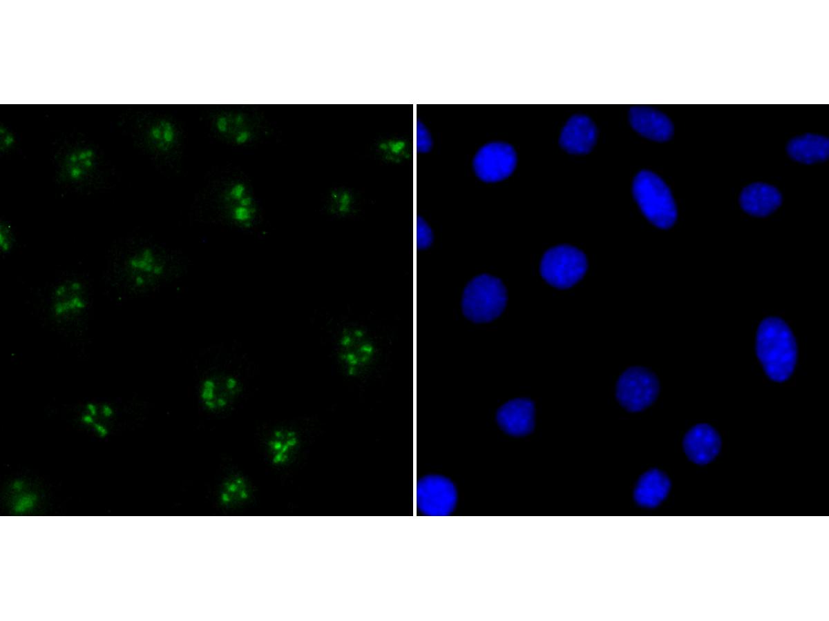 Immunocytochemistry analysis of SH-SY5Y cells labeling CENPC with Rabbit anti-CENPC antibody (ET7108-24) at 1/50 dilution.<br />
<br />
Cells were fixed in 4% paraformaldehyde for 10 minutes at 37 ℃, permeabilized with 0.05% Triton X-100 in PBS for 20 minutes, and then blocked with 2% negative goat serum for 30 minutes at room temperature. Cells were then incubated with Rabbit anti-CENPC antibody (ET7108-24) at 1/50 dilution in 2% negative goat serum overnight at 4 ℃.Alexa Fluor®488 Goat anti-Rabbit IgG  was used as the secondary antibody at 1/1,000 dilution. Nuclear DNA was labelled in blue with DAPI.