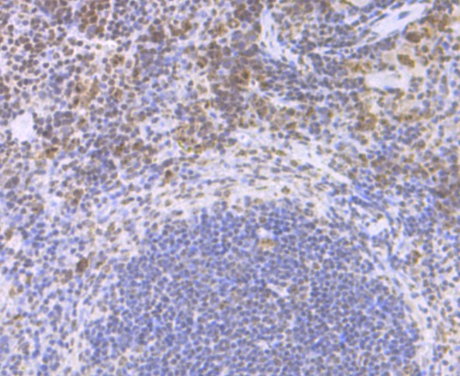 Immunohistochemical analysis of paraffin-embedded  mouse spleen tissue with Rabbit anti-CENPC antibody (ET7108-24) at 1/50 dilution.<br />
<br />
The section was pre-treated using heat mediated antigen retrieval with Tris-EDTA buffer (pH 8.0-8.4)) for 20 minutes. The tissues were blocked in 1% BSA for 20 minutes at room temperature, washed with ddH2O and PBS, and then probed with the primary antibody (ET7108-24) at 1/50 dilution for 0.5 hour at room temperature. The detection was performed using an HRP conjugated compact polymer system. DAB was used as the chromogen. Tissues were counterstained with hematoxylin and mounted with DPX.