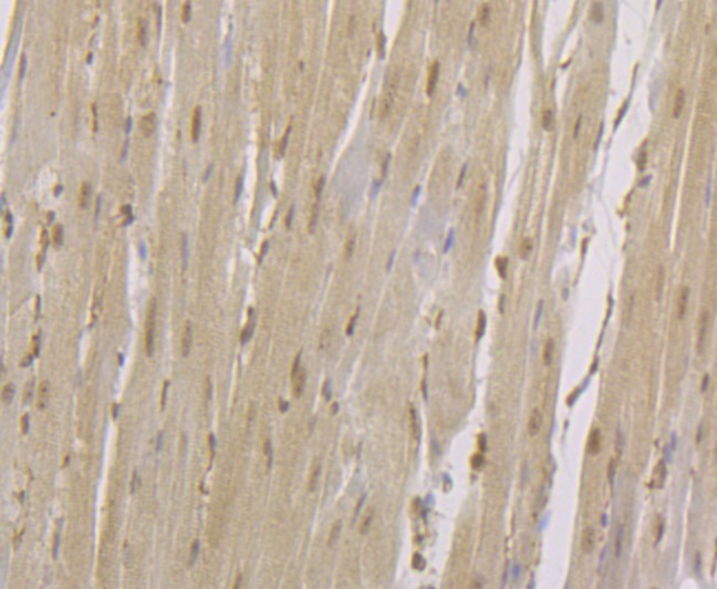Immunohistochemical analysis of paraffin-embedded  rat heart tissue with Rabbit anti-CENPC antibody (ET7108-24) at 1/50 dilution.<br />
<br />
The section was pre-treated using heat mediated antigen retrieval with Tris-EDTA buffer (pH 8.0-8.4)) for 20 minutes. The tissues were blocked in 1% BSA for 20 minutes at room temperature, washed with ddH2O and PBS, and then probed with the primary antibody (ET7108-24) at 1/50 dilution for 0.5 hour at room temperature. The detection was performed using an HRP conjugated compact polymer system. DAB was used as the chromogen. Tissues were counterstained with hematoxylin and mounted with DPX.