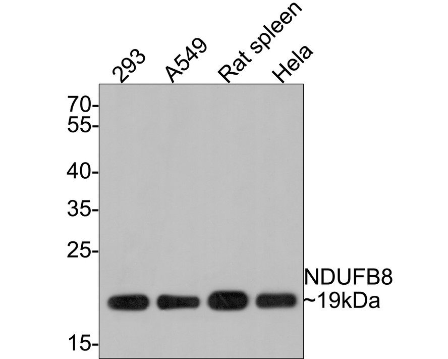 Western blot analysis of NDUFB8 on different lysates with Rabbit anti-NDUFB8 antibody (ET7108-25) at 1/500 dilution.<br />
<br />
Lane 1: 293 cell lysate (10 µg/Lane)<br />
Lane 2: A549 cell lysate (10 µg/Lane)<br />
Lane 3: Rat spleen tissue lysate (20 µg/Lane)<br />
Lane 4: Hela cell lysate (10 µg/Lane)<br />
<br />
Predicted band size: 22 kDa<br />
Observed band size: 19 kDa<br />
<br />
Exposure time: 2 minutes;<br />
<br />
12% SDS-PAGE gel.<br />
<br />
Proteins were transferred to a PVDF membrane and blocked with 5% NFDM/TBST for 1 hour at room temperature. The primary antibody (ET7108-25) at 1/500 dilution was used in 5% NFDM/TBST at room temperature for 2 hours. Goat Anti-Rabbit IgG - HRP Secondary Antibody (HA1001) at 1:300,000 dilution was used for 1 hour at room temperature.