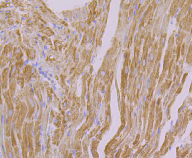Immunohistochemical analysis of paraffin-embedded  rat heart tissue with Rabbit anti-NDUFB8 antibody (ET7108-25) at 1/50 dilution.<br />
<br />
The section was pre-treated using heat mediated antigen retrieval with Tris-EDTA buffer (pH 8.0-8.4)) for 20 minutes. The tissues were blocked in 1% BSA for 20 minutes at room temperature, washed with ddH2O and PBS, and then probed with the primary antibody (ET7108-25) at 1/50 dilution for 0.5 hour at room temperature. The detection was performed using an HRP conjugated compact polymer system. DAB was used as the chromogen. Tissues were counterstained with hematoxylin and mounted with DPX.