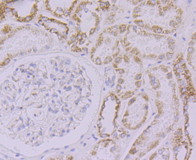 Immunohistochemical analysis of paraffin-embedded  human kidney tissue with Rabbit anti-NDUFB8 antibody (ET7108-25) at 1/50 dilution.<br />
<br />
The section was pre-treated using heat mediated antigen retrieval with Tris-EDTA buffer (pH 8.0-8.4)) for 20 minutes. The tissues were blocked in 1% BSA for 20 minutes at room temperature, washed with ddH2O and PBS, and then probed with the primary antibody (ET7108-25) at 1/50 dilution for 0.5 hour at room temperature. The detection was performed using an HRP conjugated compact polymer system. DAB was used as the chromogen. Tissues were counterstained with hematoxylin and mounted with DPX.