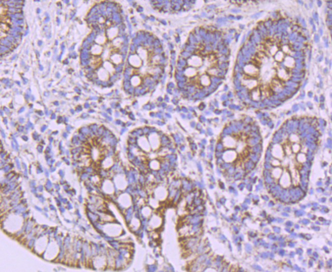 Immunohistochemical analysis of paraffin-embedded  human small intestine tissue with Rabbit anti-NDUFB8 antibody (ET7108-25) at 1/50 dilution.<br />
<br />
The section was pre-treated using heat mediated antigen retrieval with Tris-EDTA buffer (pH 8.0-8.4)) for 20 minutes. The tissues were blocked in 1% BSA for 20 minutes at room temperature, washed with ddH2O and PBS, and then probed with the primary antibody (ET7108-25) at 1/50 dilution for 0.5 hour at room temperature. The detection was performed using an HRP conjugated compact polymer system. DAB was used as the chromogen. Tissues were counterstained with hematoxylin and mounted with DPX.