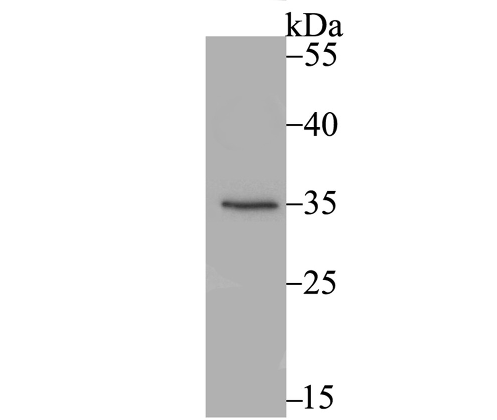 Western blot analysis of SULT2A1 on mouse kidney lysates with Rabbit anti-SULT2A1 antibody (ET7108-26) at 1/1000 dilution.<br />
<br />
Lysates/proteins at 20 µg/Lane.<br />
<br />
Predicted band size: 34 kDa<br />
Observed band size: 34 kDa<br />
<br />
Exposure time: 2 minutes;<br />
<br />
10% SDS-PAGE gel.<br />
<br />
Proteins were transferred to a PVDF membrane and blocked with 5% NFDM/TBST for 1 hour at room temperature. The primary antibody (ET7108-26) at 1/1000 dilution was used in 5% NFDM/TBST at room temperature for 2 hours. Goat Anti-Rabbit IgG - HRP Secondary Antibody (HA1001) at 1:40,000 dilution was used for 1 hour at room temperature.