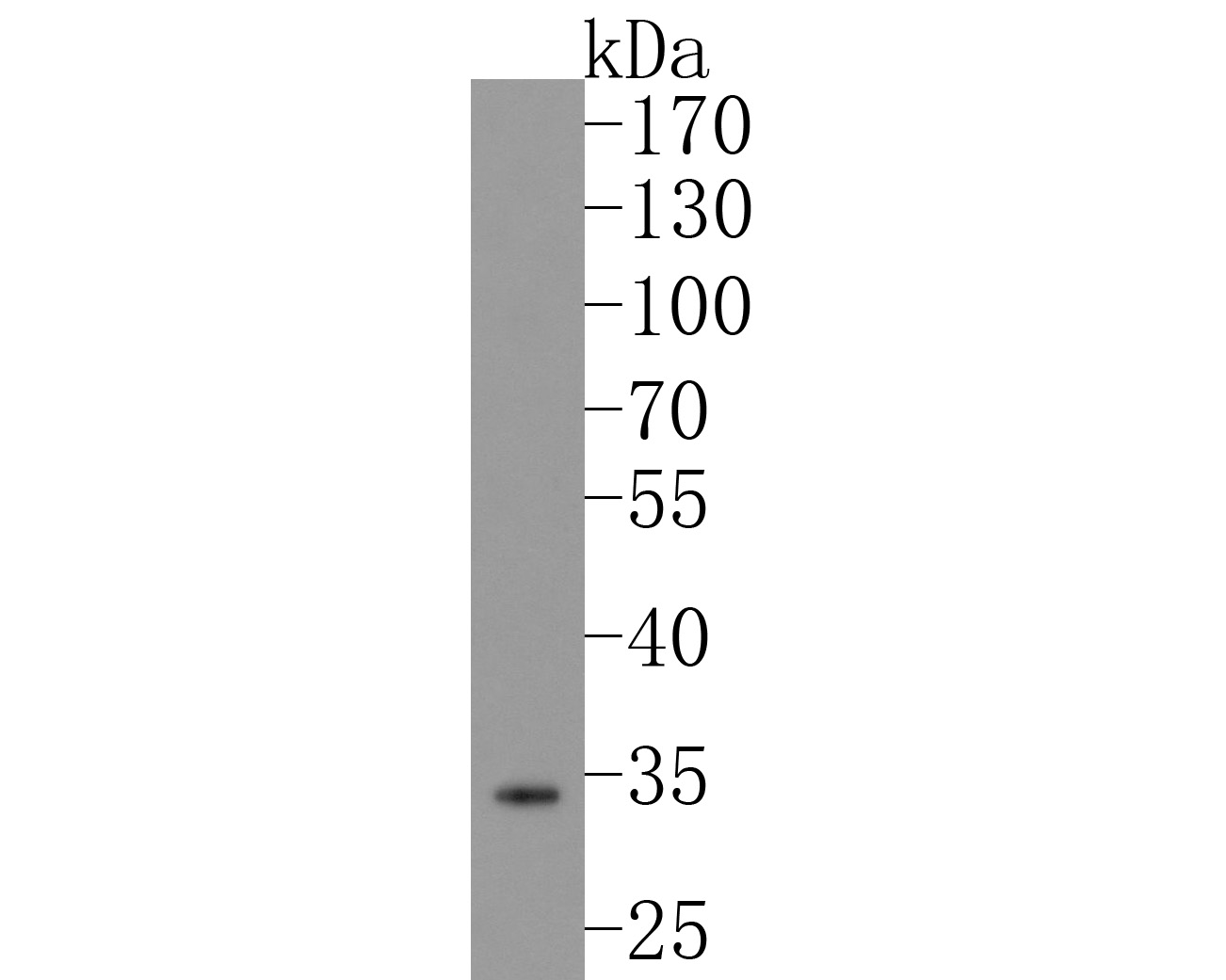 Western blot analysis of SULT2A1 on human liver lysates with Rabbit anti-SULT2A1 antibody (ET7108-26) at 1/1000 dilution.<br />
<br />
Lysates/proteins at 20 µg/Lane.<br />
<br />
Predicted band size: 34 kDa<br />
Observed band size: 34 kDa<br />
<br />
Exposure time: 2 minutes;<br />
<br />
10% SDS-PAGE gel.<br />
<br />
Proteins were transferred to a PVDF membrane and blocked with 5% NFDM/TBST for 1 hour at room temperature. The primary antibody (ET7108-26) at 1/1000 dilution was used in 5% NFDM/TBST at room temperature for 2 hours. Goat Anti-Rabbit IgG - HRP Secondary Antibody (HA1001) at 1:200,000 dilution was used for 1 hour at room temperature.