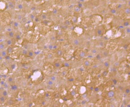 Immunohistochemical analysis of paraffin-embedded  rat adrenal gland tissue with Rabbit anti-SULT2A1 antibody (ET7108-26) at 1/50 dilution.<br />
<br />
The section was pre-treated using heat mediated antigen retrieval with Tris-EDTA buffer (pH 8.0-8.4)) for 20 minutes. The tissues were blocked in 1% BSA for 20 minutes at room temperature, washed with ddH2O and PBS, and then probed with the primary antibody (ET7108-26) at 1/50 dilution for 0.5 hour at room temperature. The detection was performed using an HRP conjugated compact polymer system. DAB was used as the chromogen. Tissues were counterstained with hematoxylin and mounted with DPX.