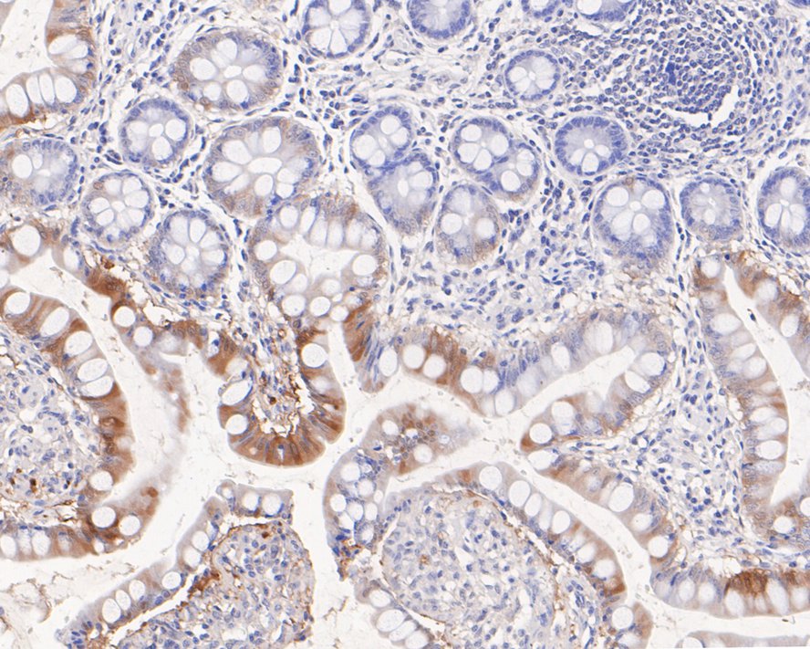 Immunohistochemical analysis of paraffin-embedded  human small intestine tissue with Rabbit anti-SULT2A1 antibody (ET7108-26) at 1/50 dilution.<br />
<br />
The section was pre-treated using heat mediated antigen retrieval with Tris-EDTA buffer (pH 8.0-8.4)) for 20 minutes. The tissues were blocked in 1% BSA for 20 minutes at room temperature, washed with ddH2O and PBS, and then probed with the primary antibody (ET7108-26) at 1/50 dilution for 0.5 hour at room temperature. The detection was performed using an HRP conjugated compact polymer system. DAB was used as the chromogen. Tissues were counterstained with hematoxylin and mounted with DPX.
