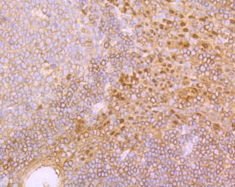 Immunohistochemical analysis of paraffin-embedded human tonsile tissue with Rabbit anti-IRAK2 antibody (ET7108-29) at 1/50 dilution.<br />
<br />
The section was pre-treated using heat mediated antigen retrieval with Tris-EDTA buffer (pH 9.0) for 20 minutes. The tissues were blocked in 1% BSA for 20 minutes at room temperature, washed with ddH2O and PBS, and then probed with the primary antibody (ET7108-29) at 1/50 dilution for 0.5 hour at room temperature. The detection was performed using an HRP conjugated compact polymer system. DAB was used as the chromogen. Tissues were counterstained with hematoxylin and mounted with DPX.