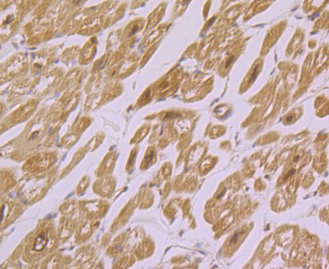 Immunohistochemical analysis of paraffin-embedded human heart tissue with Rabbit anti-IRAK2 antibody (ET7108-29) at 1/50 dilution.<br />
<br />
The section was pre-treated using heat mediated antigen retrieval with Tris-EDTA buffer (pH 9.0) for 20 minutes. The tissues were blocked in 1% BSA for 20 minutes at room temperature, washed with ddH2O and PBS, and then probed with the primary antibody (ET7108-29) at 1/50 dilution for 0.5 hour at room temperature. The detection was performed using an HRP conjugated compact polymer system. DAB was used as the chromogen. Tissues were counterstained with hematoxylin and mounted with DPX.