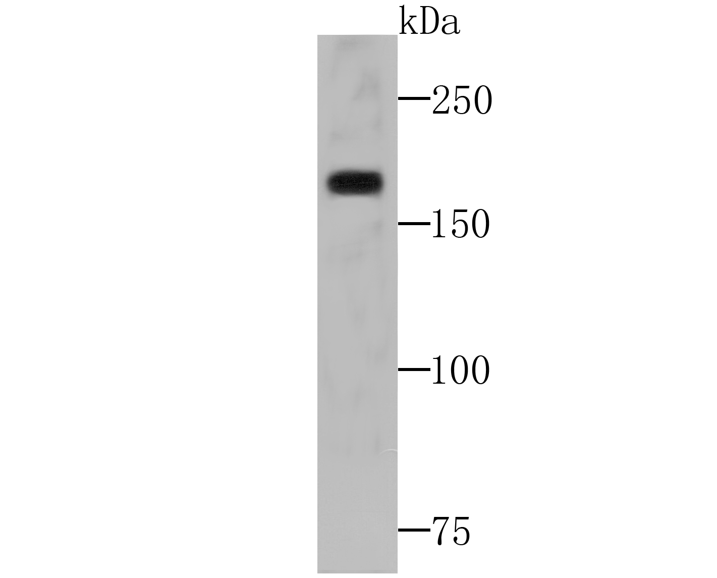 Western blot analysis of WSTF on SiHa lysates with Rabbit anti-WSTF antibody (ET7108-32) at 1/500 dilution.<br />
<br />
Lysates/proteins at 10 µg/Lane.<br />
<br />
Predicted band size: 171 kDa<br />
Observed band size: 171 kDa<br />
<br />
Exposure time: 2 minutes;<br />
<br />
6% SDS-PAGE gel.<br />
<br />
Proteins were transferred to a PVDF membrane and blocked with 5% NFDM/TBST for 1 hour at room temperature. The primary antibody (ET7108-32) at 1/500 dilution was used in 5% NFDM/TBST at room temperature for 2 hours. Goat Anti-Rabbit IgG - HRP Secondary Antibody (HA1001) at 1:200,000 dilution was used for 1 hour at room temperature.