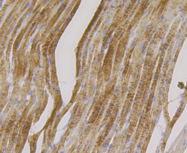 Immunohistochemical analysis of paraffin-embedded rat heart tissue with Rabbit anti-FHL2 antibody (ET7108-33) at 1/50 dilution.<br />
<br />
The section was pre-treated using heat mediated antigen retrieval with Tris-EDTA buffer (pH 8.0-8.4) for 20 minutes. The tissues were blocked in 1% BSA for 20 minutes at room temperature, washed with ddH2O and PBS, and then probed with the primary antibody (ET7108-33) at 1/50 dilution for 0.5 hour at room temperature. The detection was performed using an HRP conjugated compact polymer system. DAB was used as the chromogen. Tissues were counterstained with hematoxylin and mounted with DPX.