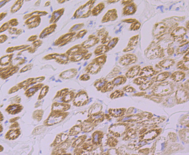 Immunohistochemical analysis of paraffin-embedded human fetal heart with Rabbit anti-FHL2 antibody (ET7108-33) at 1/50 dilution.<br />
<br />
The section was pre-treated using heat mediated antigen retrieval with Tris-EDTA buffer (pH 8.0-8.4) for 20 minutes. The tissues were blocked in 1% BSA for 20 minutes at room temperature, washed with ddH2O and PBS, and then probed with the primary antibody (ET7108-33) at 1/50 dilution for 0.5 hour at room temperature. The detection was performed using an HRP conjugated compact polymer system. DAB was used as the chromogen. Tissues were counterstained with hematoxylin and mounted with DPX.