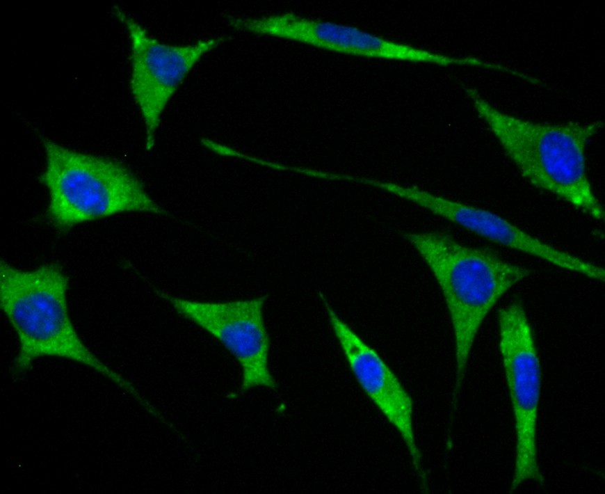 ICC staining of GEF H1 in SH-SY5Y cells (green). Formalin fixed cells were permeabilized with 0.1% Triton X-100 in TBS for 10 minutes at room temperature and blocked with 1% Blocker BSA for 15 minutes at room temperature. Cells were probed with the primary antibody (ET7108-34, 1/50) for 1 hour at room temperature, washed with PBS. Alexa Fluor®488 Goat anti-Rabbit IgG was used as the secondary antibody at 1/1,000 dilution. The nuclear counter stain is DAPI (blue).