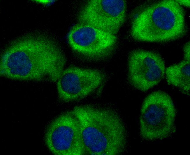 ICC staining of GEF H1 in HUVEC cells (green). Formalin fixed cells were permeabilized with 0.1% Triton X-100 in TBS for 10 minutes at room temperature and blocked with 1% Blocker BSA for 15 minutes at room temperature. Cells were probed with the primary antibody (ET7108-34, 1/50) for 1 hour at room temperature, washed with PBS. Alexa Fluor®488 Goat anti-Rabbit IgG was used as the secondary antibody at 1/1,000 dilution. The nuclear counter stain is DAPI (blue).