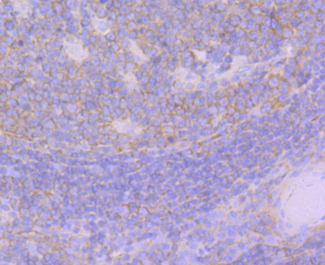 Immunohistochemical analysis of paraffin-embedded human tonsil tissue using anti-GEF H1 antibody. The section was pre-treated using heat mediated antigen retrieval with Tris-EDTA buffer (pH 8.0-8.4) for 20 minutes.The tissues were blocked in 5% BSA for 30 minutes at room temperature, washed with ddH2O and PBS, and then probed with the primary antibody (ET7108-34, 1/50) for 30 minutes at room temperature. The detection was performed using an HRP conjugated compact polymer system. DAB was used as the chromogen. Tissues were counterstained with hematoxylin and mounted with DPX.