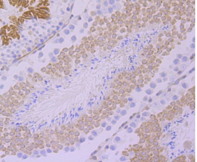 Immunohistochemical analysis of paraffin-embedded mouse testis tissue using anti-GEF H1 antibody. The section was pre-treated using heat mediated antigen retrieval with Tris-EDTA buffer (pH 8.0-8.4) for 20 minutes.The tissues were blocked in 5% BSA for 30 minutes at room temperature, washed with ddH2O and PBS, and then probed with the primary antibody (ET7108-34, 1/50) for 30 minutes at room temperature. The detection was performed using an HRP conjugated compact polymer system. DAB was used as the chromogen. Tissues were counterstained with hematoxylin and mounted with DPX.