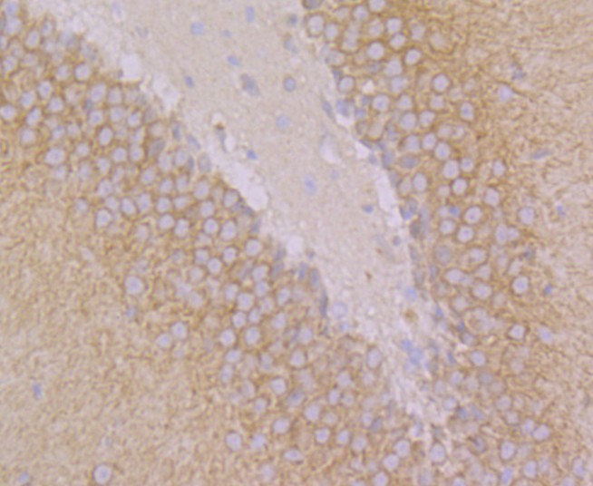 Immunohistochemical analysis of paraffin-embedded rat brain tissue using anti-GEF H1 antibody. The section was pre-treated using heat mediated antigen retrieval with Tris-EDTA buffer (pH 8.0-8.4) for 20 minutes.The tissues were blocked in 5% BSA for 30 minutes at room temperature, washed with ddH2O and PBS, and then probed with the primary antibody (ET7108-34, 1/50) for 30 minutes at room temperature. The detection was performed using an HRP conjugated compact polymer system. DAB was used as the chromogen. Tissues were counterstained with hematoxylin and mounted with DPX.
