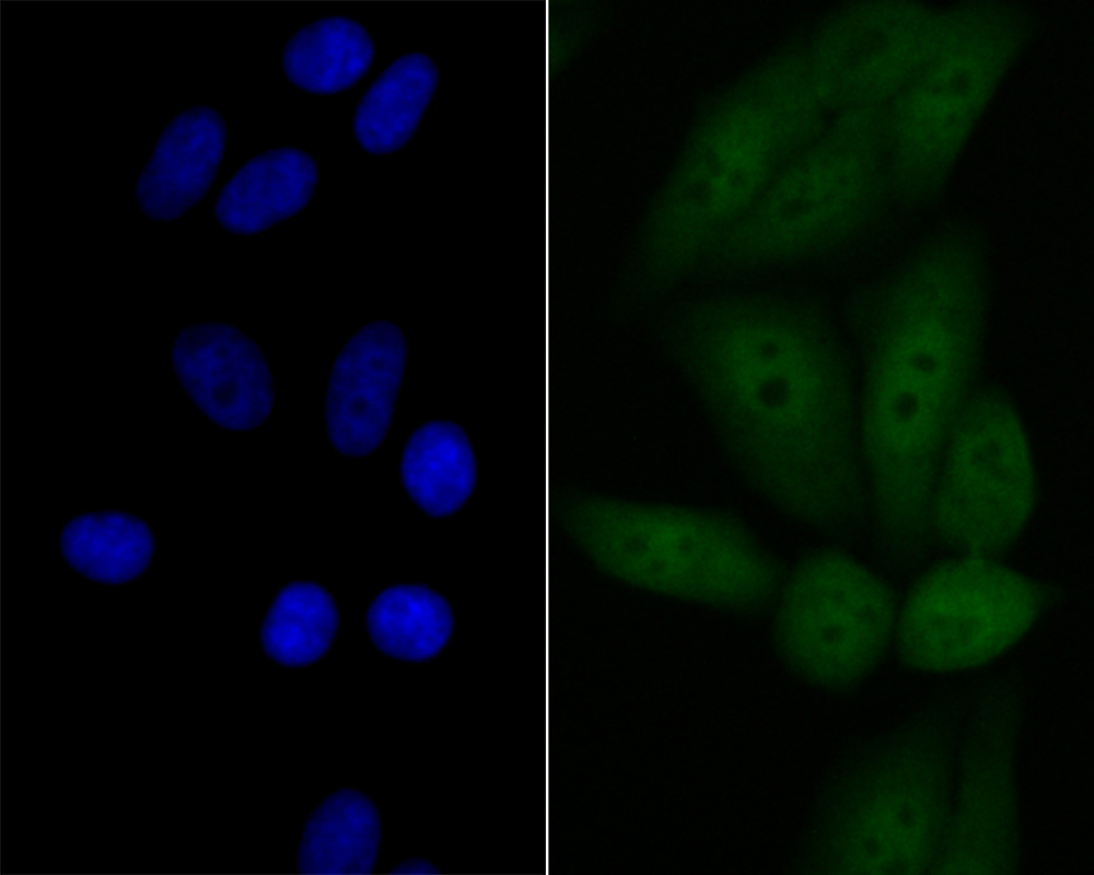 Immunocytochemistry analysis of HepG2 cells labeling p53 DINP1 with Rabbit anti-p53 DINP1 antibody (ET7108-35) at 1/50 dilution.<br />
<br />
Cells were fixed in 4% paraformaldehyde for 10 minutes at 37 ℃, permeabilized with 0.05% Triton X-100 in PBS for 20 minutes, and then blocked with 2% negative goat serum for 30 minutes at room temperature. Cells were then incubated with Rabbit anti-p53 DINP1 antibody (ET7108-35) at 1/50 dilution in 2% negative goat serum overnight at 4 ℃.Alexa Fluor®488 Goat anti-Rabbit IgG  was used as the secondary antibody at 1/1,000 dilution.Nuclear DNA was labelled in blue with DAPI.