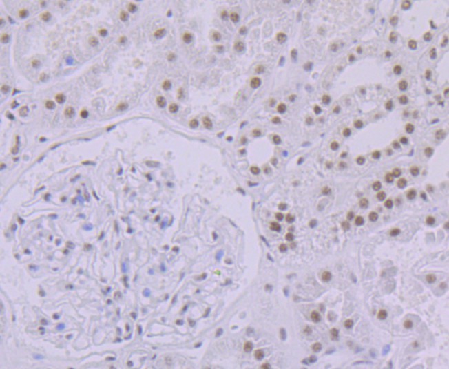 Immunohistochemical analysis of paraffin-embedded human kidney tissue with Rabbit anti-SF3B3 antibody (ET7108-36) at 1/50 dilution.<br />
<br />
The section was pre-treated using heat mediated antigen retrieval with sodium citrate buffer (pH 6.0) for 2 minutes. The tissues were blocked in 1% BSA for 20 minutes at room temperature, washed with ddH2O and PBS, and then probed with the primary antibody (ET7108-36) at 1/50 dilution for 1 hour at room temperature. The detection was performed using an HRP conjugated compact polymer system. DAB was used as the chromogen. Tissues were counterstained with hematoxylin and mounted with DPX.