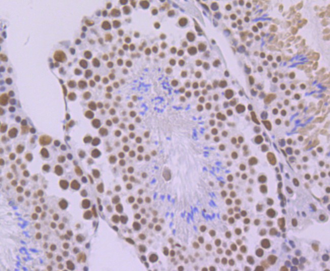 Immunohistochemical analysis of paraffin-embedded mouse testis tissue with Rabbit anti-SF3B3 antibody (ET7108-36) at 1/50 dilution.<br />
<br />
The section was pre-treated using heat mediated antigen retrieval with sodium citrate buffer (pH 6.0) for 2 minutes. The tissues were blocked in 1% BSA for 20 minutes at room temperature, washed with ddH2O and PBS, and then probed with the primary antibody (ET7108-36) at 1/50 dilution for 1 hour at room temperature. The detection was performed using an HRP conjugated compact polymer system. DAB was used as the chromogen. Tissues were counterstained with hematoxylin and mounted with DPX.