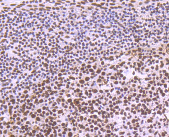 Immunohistochemical analysis of paraffin-embedded human tonsil tissue with Rabbit anti-SF3B3 antibody (ET7108-36) at 1/50 dilution.<br />
<br />
The section was pre-treated using heat mediated antigen retrieval with sodium citrate buffer (pH 6.0) for 2 minutes. The tissues were blocked in 1% BSA for 20 minutes at room temperature, washed with ddH2O and PBS, and then probed with the primary antibody (ET7108-36) at 1/50 dilution for 1 hour at room temperature. The detection was performed using an HRP conjugated compact polymer system. DAB was used as the chromogen. Tissues were counterstained with hematoxylin and mounted with DPX.