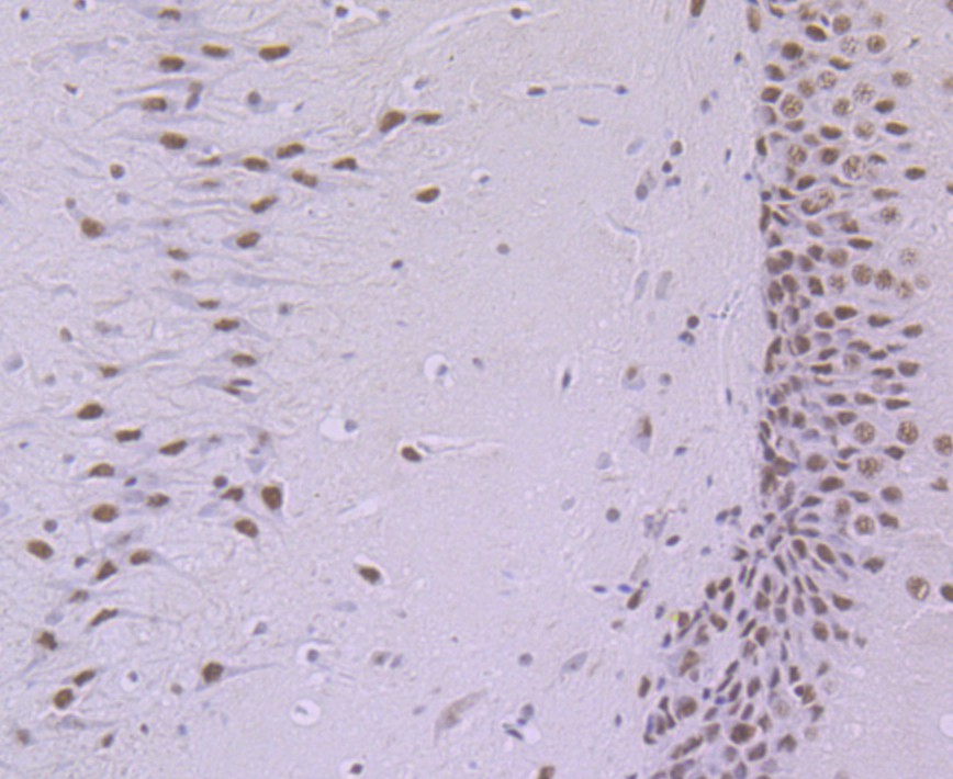 Immunohistochemical analysis of paraffin-embedded rat brain tissue with Rabbit anti-SF3B3 antibody (ET7108-36) at 1/50 dilution.<br />
<br />
The section was pre-treated using heat mediated antigen retrieval with sodium citrate buffer (pH 6.0) for 2 minutes. The tissues were blocked in 1% BSA for 20 minutes at room temperature, washed with ddH2O and PBS, and then probed with the primary antibody (ET7108-36) at 1/50 dilution for 1 hour at room temperature. The detection was performed using an HRP conjugated compact polymer system. DAB was used as the chromogen. Tissues were counterstained with hematoxylin and mounted with DPX.