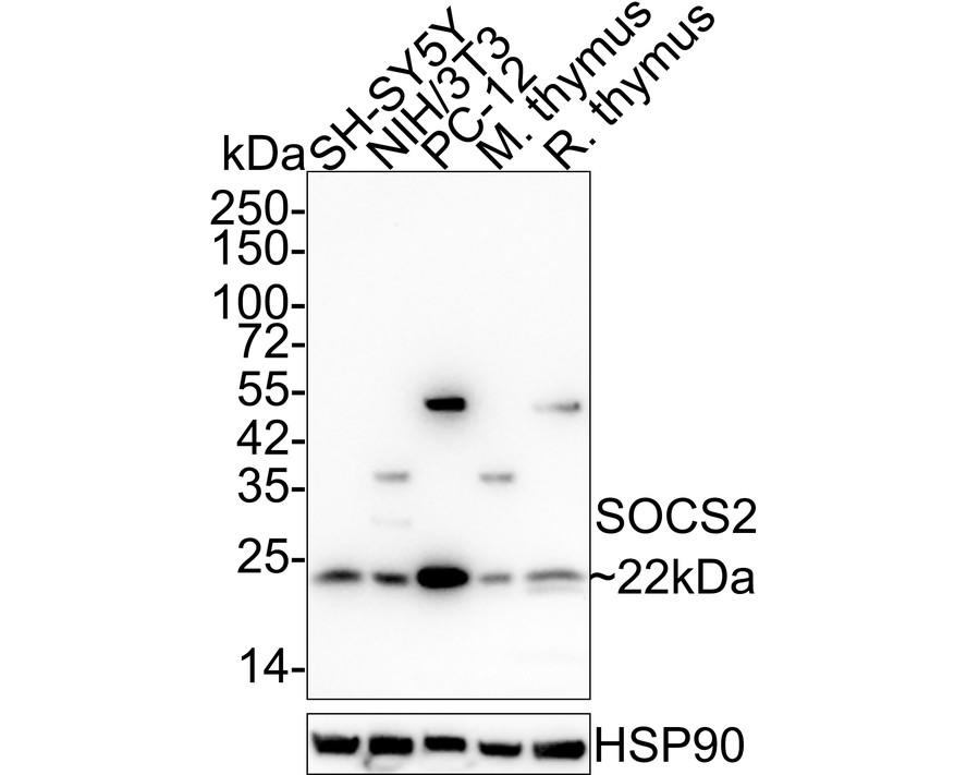 Western blot analysis of SOCS2 on different lysates using anti-SOCS2 antibody at 1/1,000 dilution.<br />
 Positive control:<br />
 Lane 1: Human placenta <br />
  Lane 2: SH-SY-5Y